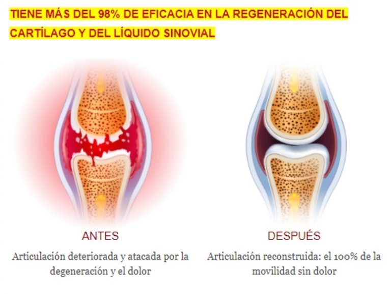 antes-y-despues-rodilla-768x577-1